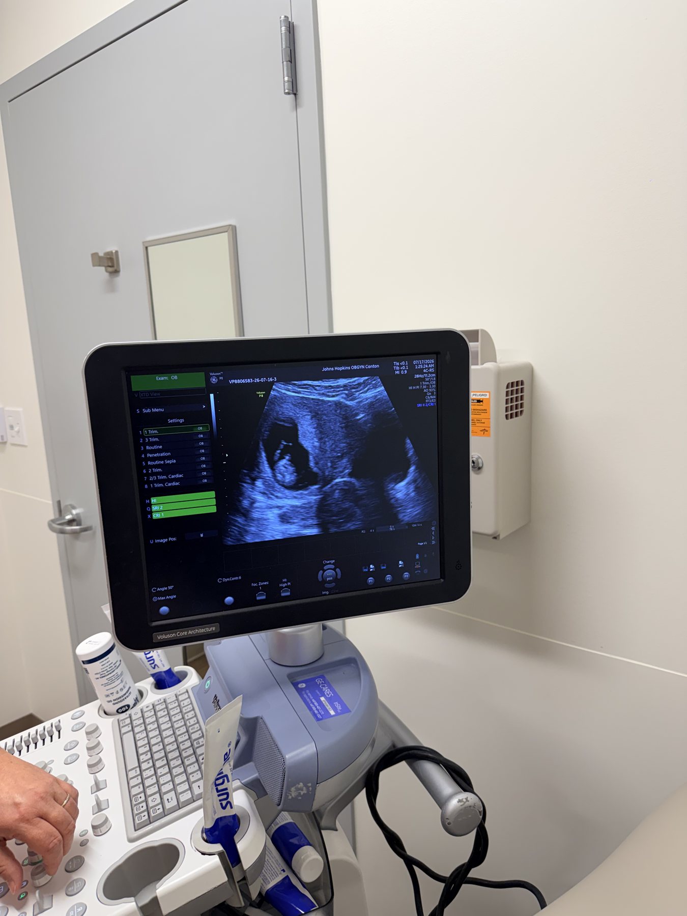 First ultrasound appointment