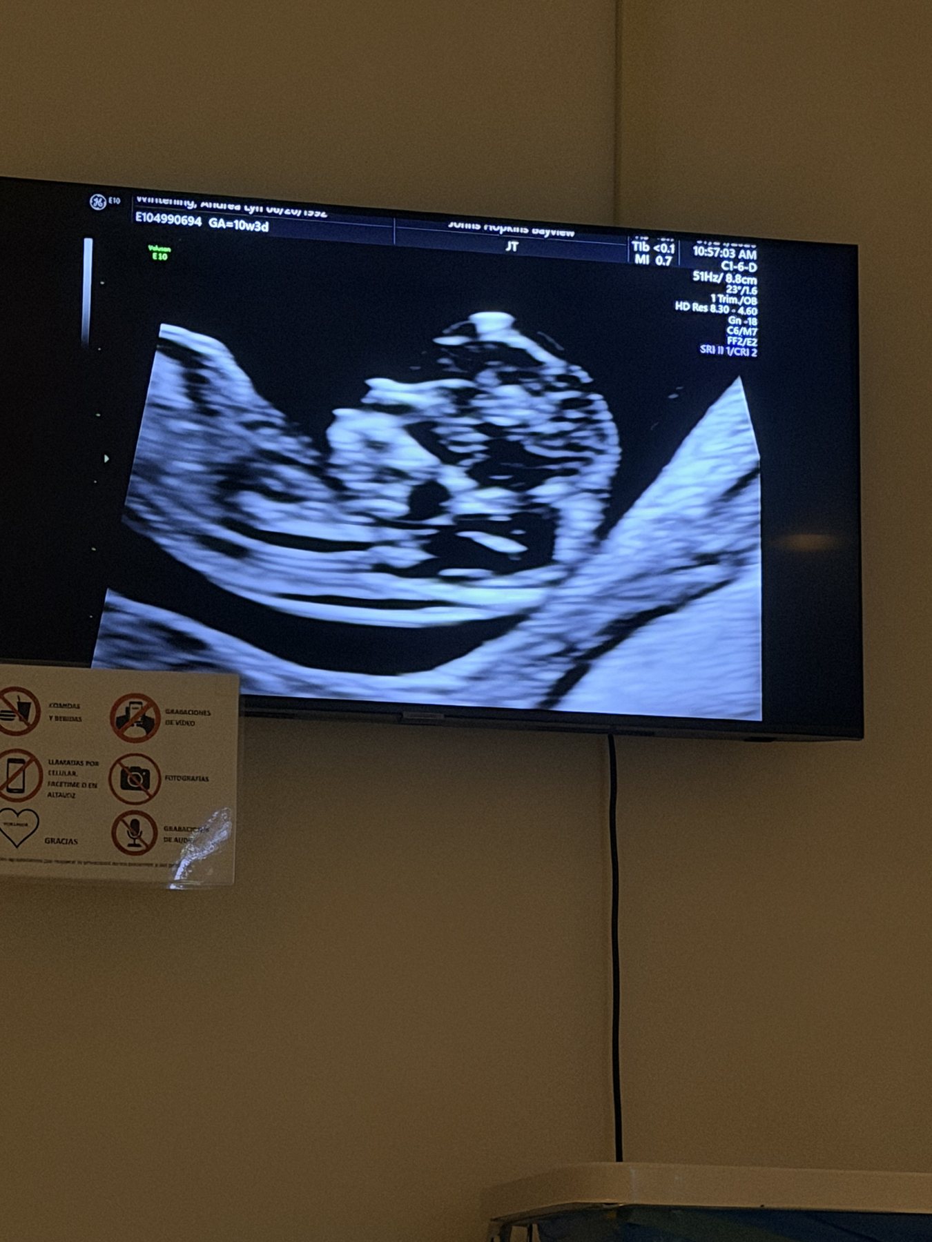 Ultrasound on the big screen