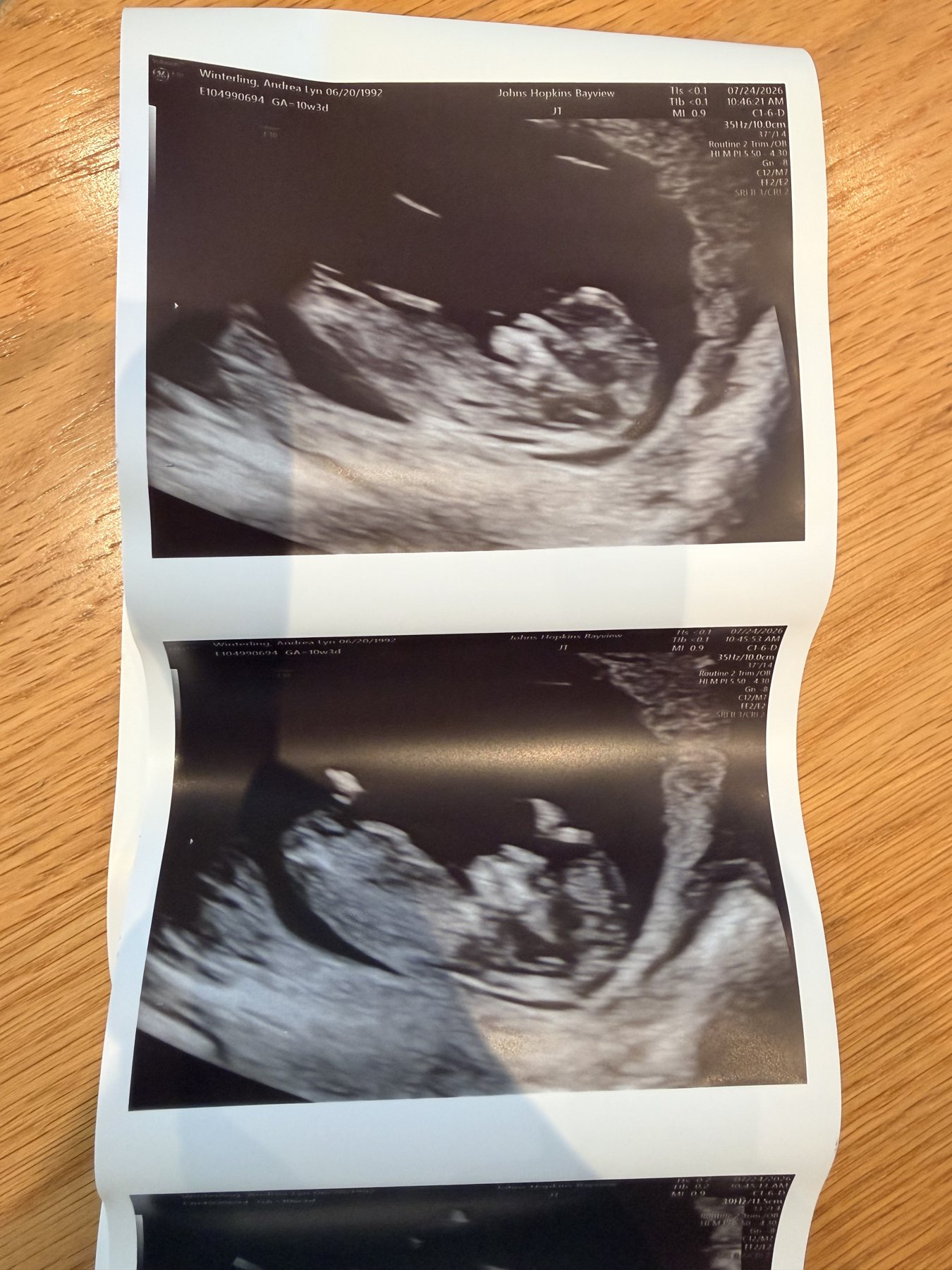 Sonogram photo strip