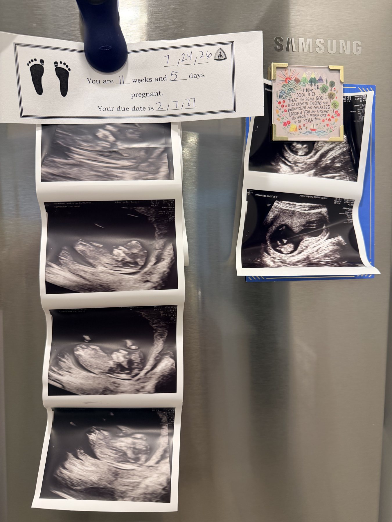 Sonogram photos on the fridge